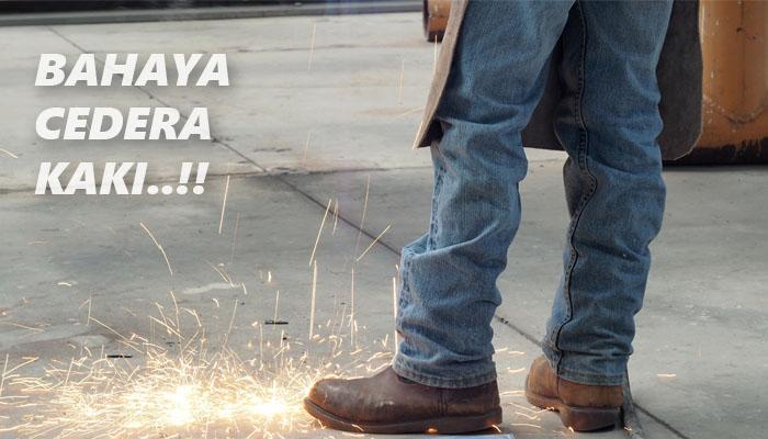 Cedera Kaki Paling Umum Yang Terjadi di Tempat Kerja!